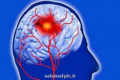 ریسک سکته مغزی در زنان جوان بیشتر است