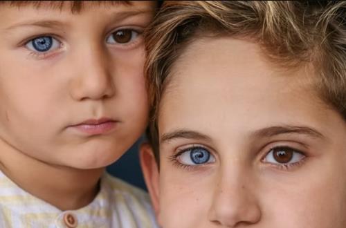 وقتی رنگ چشم ها متفاوت می باشد، عکس