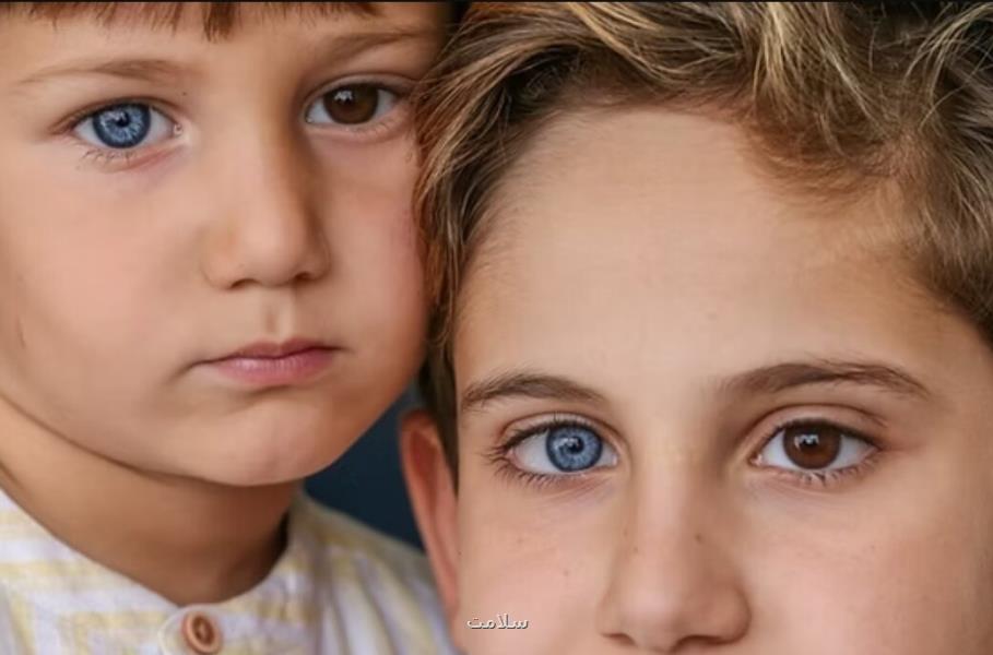وقتی رنگ چشم ها متفاوت می باشد، عکس