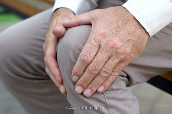 چه طور جلوی آرتروز را بگیریم