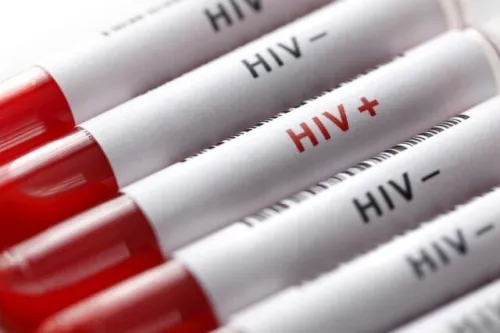 شروع پویش من هم تست HIV می دهم از امروز تا ۲۰ آذرماه