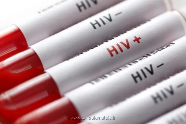شروع پویش من هم تست HIV می دهم از امروز تا ۲۰ آذرماه
