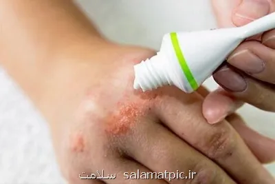 آلرژی های ناشی از محصولات آرایشی، چالشی جدی اما قابل پیشگیری