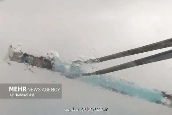 فریز جنین چیست و برای چه کسانی سفارش می شود؟