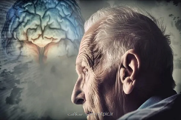 مکمل گلوکوزامین با پیشرفت سریع تر زوال عقل مرتبط می باشد