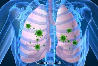 تاثیر داروی پوكی استخوان در مقابله با ذات الریه